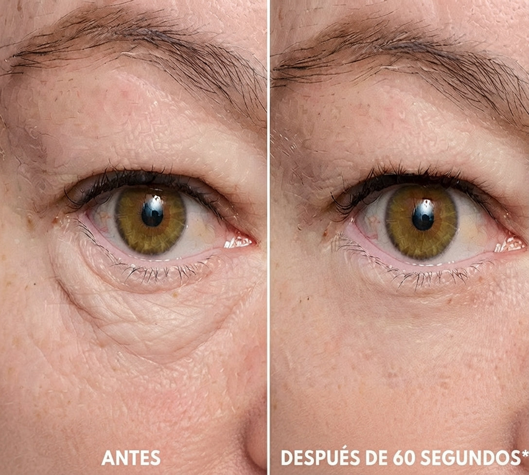 Gel tensor rejuvenecedor de ojos